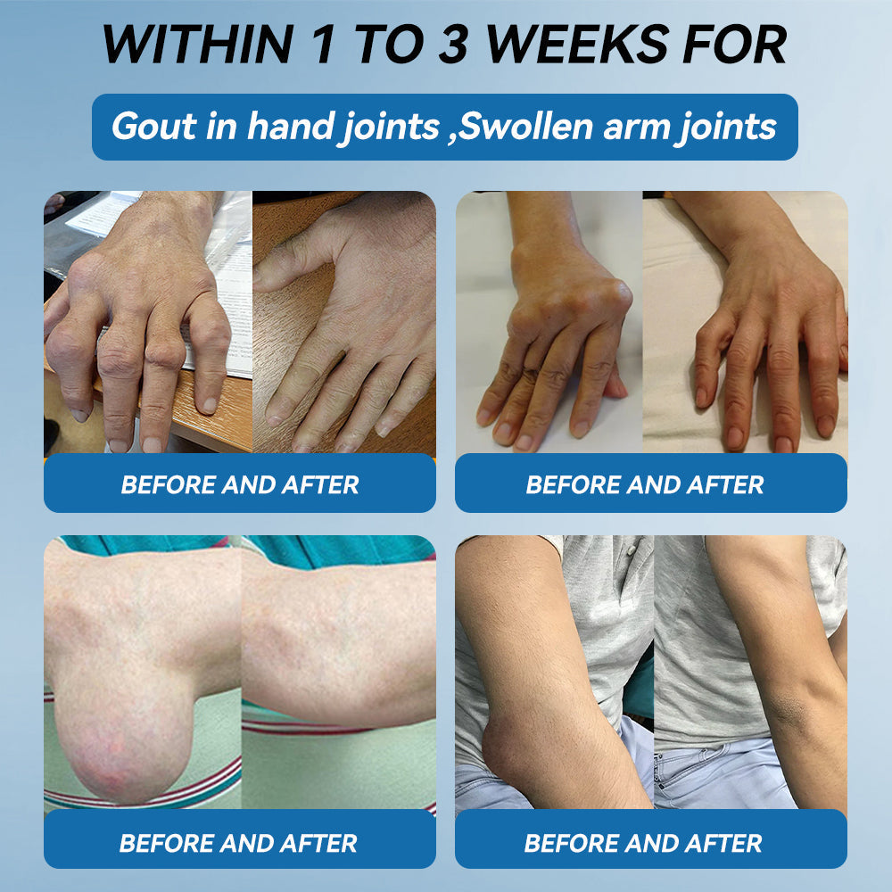 𝖯𝗂𝖼𝗱𝗼® BPC-157 Joint Healing Cream 🦴Treats Arthritis, Neuropathy, Rheumatism, Sports Injuries & More🦿🦿🦿