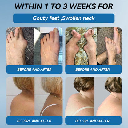 𝖯𝗂𝖼𝗱𝗼® BPC-157 Joint Healing Cream 🦴Treats Arthritis, Neuropathy, Rheumatism, Sports Injuries & More🦿🦿🦿
