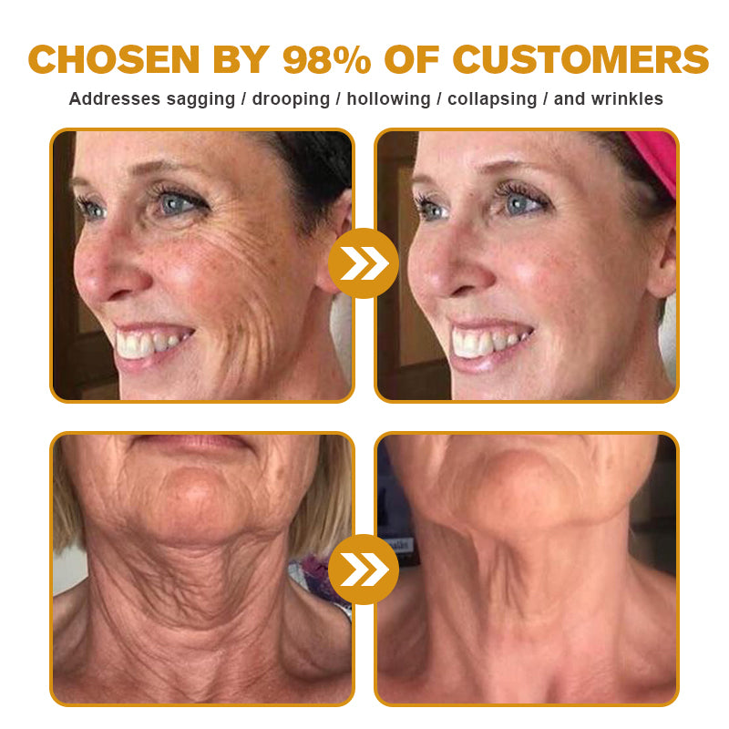 Made and shipped from the US🎁--Awzlove® Botox Bee Venom Wrinkle Removal Roll-On Cream-Last Day Promotion 70% OFF 🎁