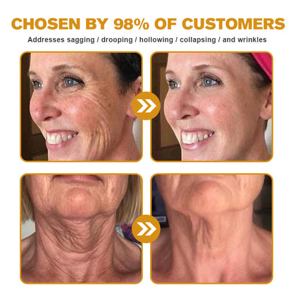 Made and shipped from the US🎁--Awzlove® Botox Bee Venom Wrinkle Removal Roll-On Cream-Last Day Promotion 70% OFF 🎁